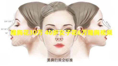 隆胸花30万 40岁女子花6万隆胸视频